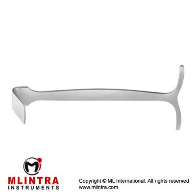 Smillie Retractor Stainless Steel, 14 cm - 5 1/2" Blade Size 12 x 13 mm Smillie Retractor Stainless Steel, 14 cm - 5 1/2" Blade Size 12 x 13 mm